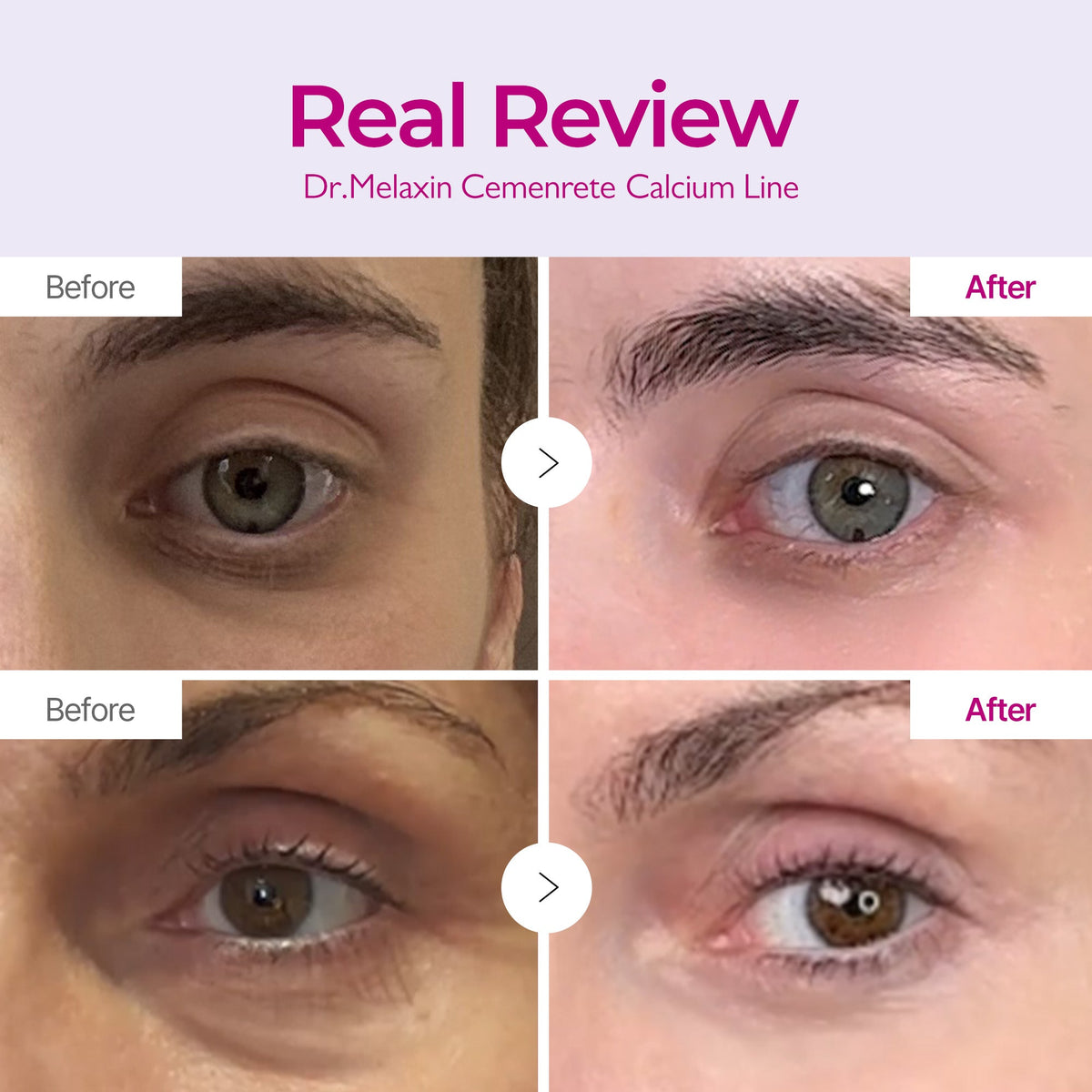 Calcium Intense Ampoule