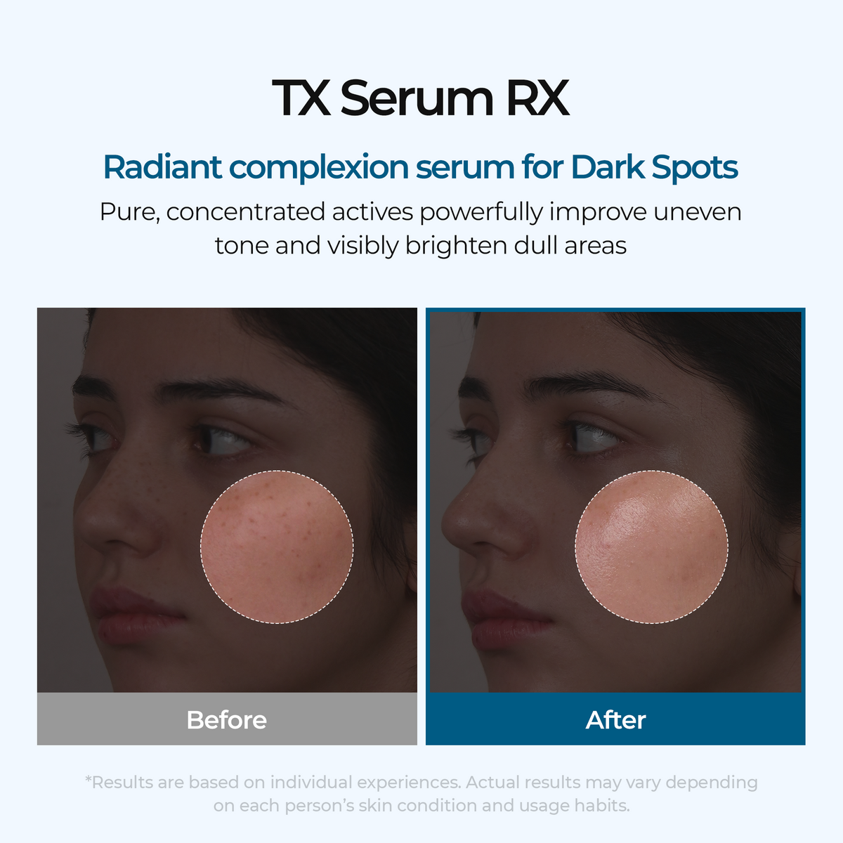TX Serum RX