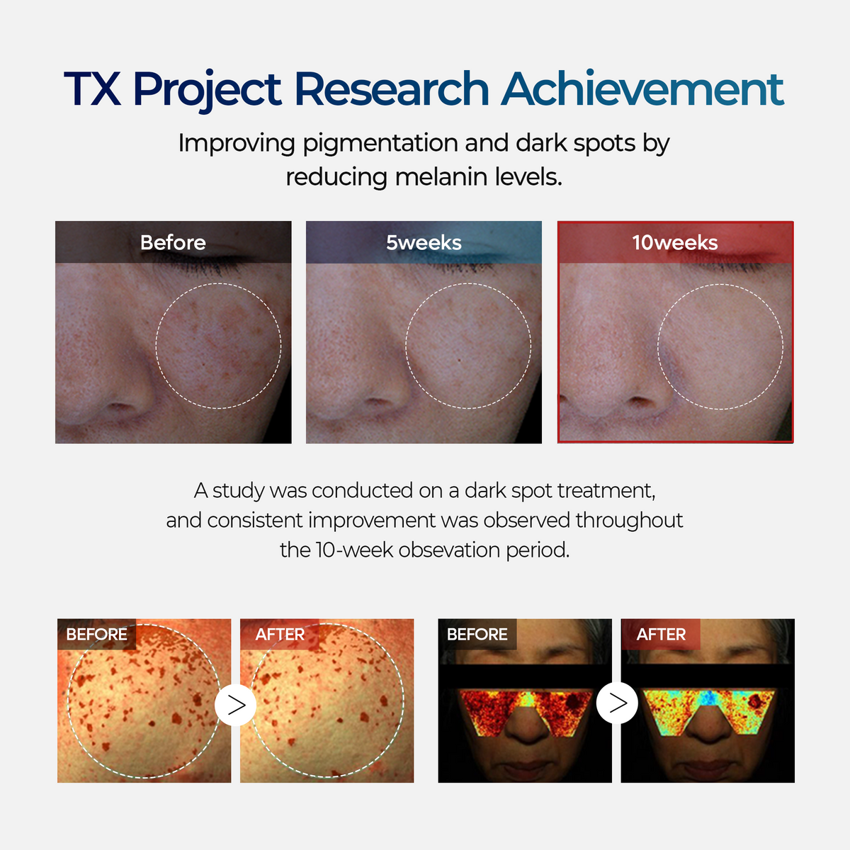 TX Serum RX